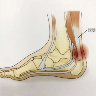 足球跟腱炎(足跟腱炎用什么药效果好)