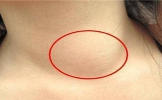 中肿甲状腺b超(甲状腺腺肿b超表现)