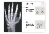 骨龄测试足球(骨龄是测手准还是测脚准)