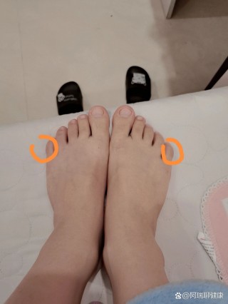 足球鞋磨脚趾(足球鞋磨脚趾头怎么办)