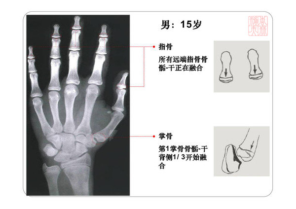 骨龄测试足球(骨龄是测手准还是测脚准)  第1张