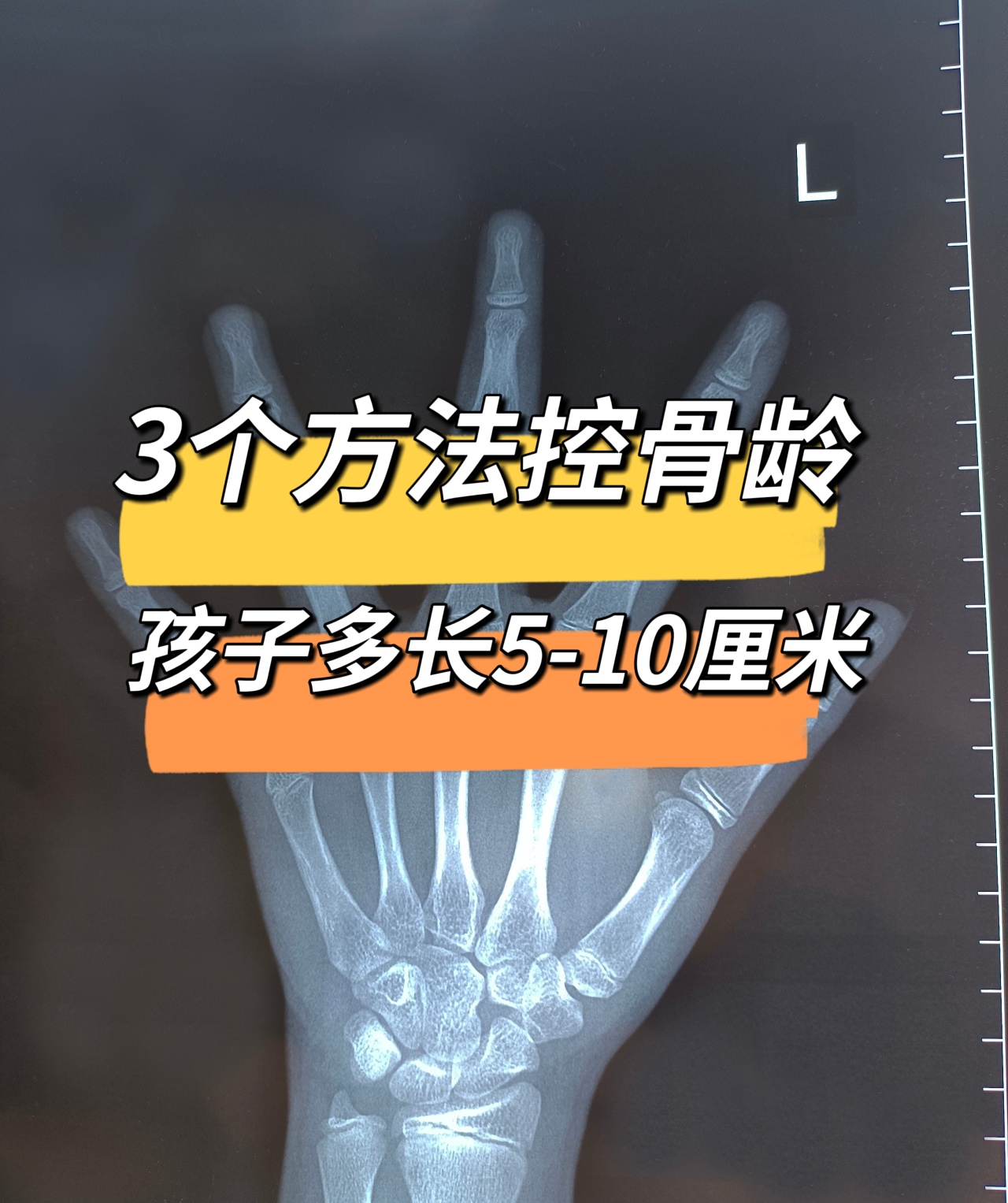 骨龄测试足球(骨龄是测手准还是测脚准)  第2张