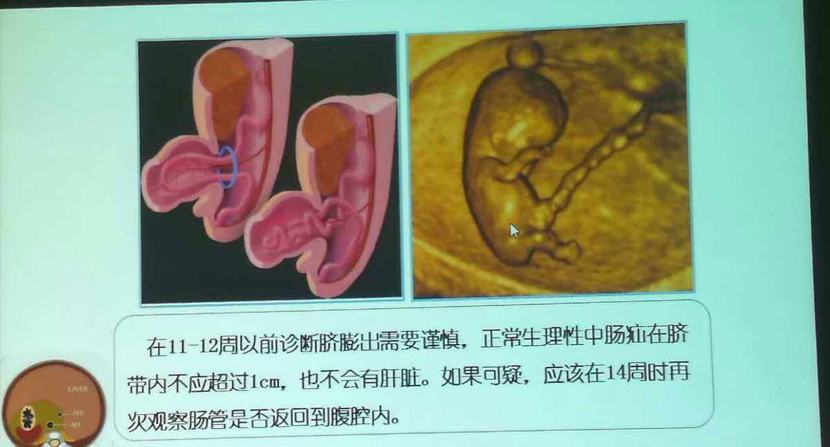 产科彩超中孕(产科彩超孕几周做)，产科彩超更佳检查时间，孕中期  第1张